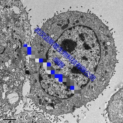 武汉迈斯普 生物电镜检测服务
